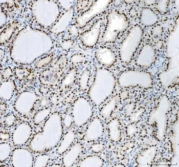 Nucleophosmin Antibody (NPM1) - image 1