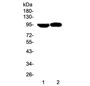 Prolactin Receptor Antibody - image 1