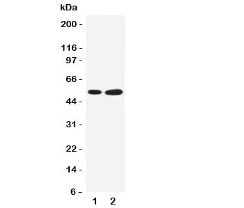 SBP Antibody Selenium Binding Protein - image 1