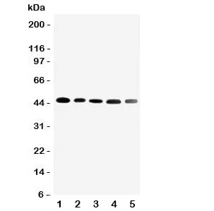CBG Antibody Cortisol Binding Globulin - image 1