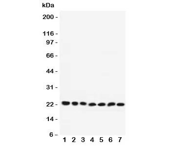 RAB9A Antibody - image 1