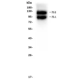 Progesterone Receptor Antibody - image 1