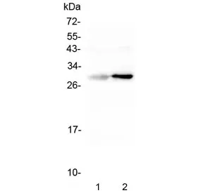 Serum Amyloid P Antibody - image 1