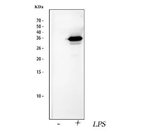 IL1 beta Antibody - image 1