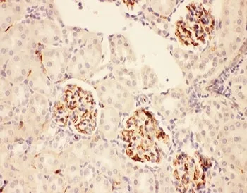 ACTH Antibody - image 1