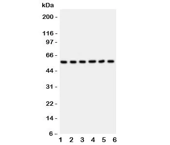 AKT2 Antibody - image 1