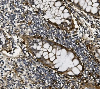 VEGF Antibody - image 1