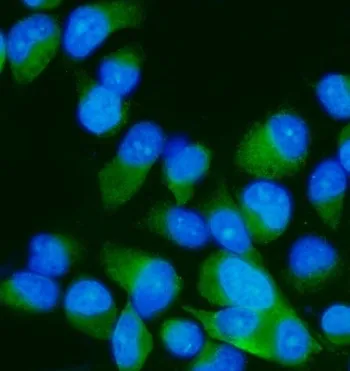 MEK7 Antibody / MAP2K7 / MKK7 - image 1