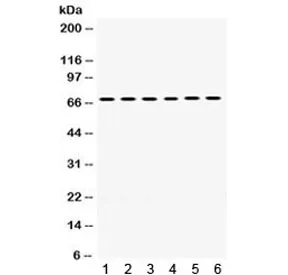 PDPK1 Antibody / 3-phosphoinositide-dependent protein kinase 1 - image 1