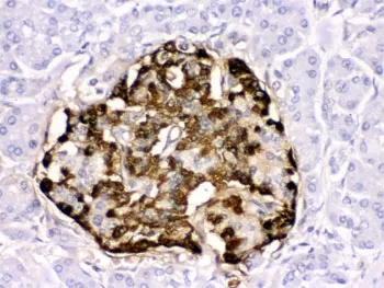 GLP-1 Antibody / Glucagon-like peptide 1 - image 1