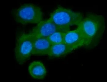 Cystatin B Antibody / CSTB / Stefin B - image 1