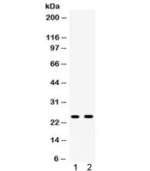 APOA1 Antibody / Apolipoprotein A I - image 1
