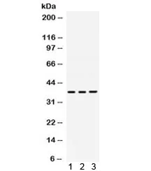 DNA polymerase beta Antibody / POLB - image 1