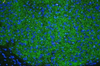 Tyrosine Hydroxylase Antibody / TH - image 1