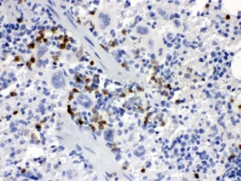 Macrophage Colony stimulating factor 1 Antibody / Csf1 - image 1