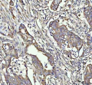 Granulocyte-Colony Stimulating Factor Antibody / CSF3 - image 1