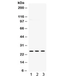 PGP9.5 / UchL1 Antibody - image 1