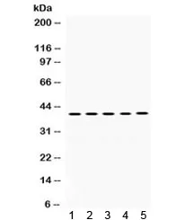 Oncostatin M Antibody / OSM - image 1