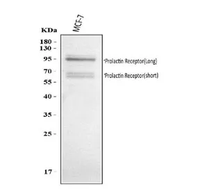 Prolactin Receptor Antibody / PRLR - image 1