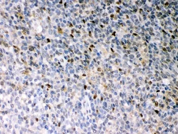 PU.1 Antibody / SPI1 - image 1