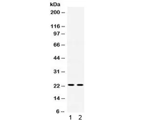 IGFBP5 Antibody - image 1