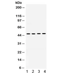 PAR1 Antibody / F2R / Thrombin Receptor - image 1