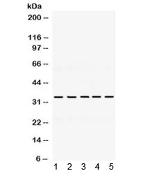 TIMP3 Antibody - image 1