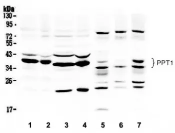 PPT1 Antibody - image 1