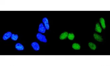 RAB9A Antibody - image 1