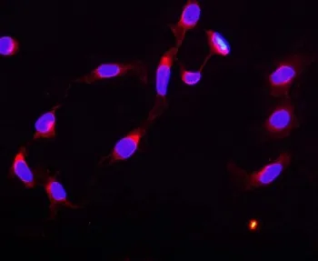 STAT5b Antibody - image 1