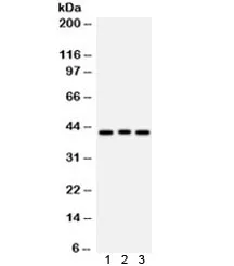 Ataxin 3 Antibody / ATXN3 - image 1
