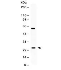 RAB11A Antibody - image 1