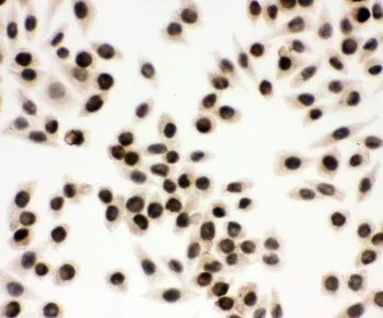 EWS Antibody / EWSR1 - image 1