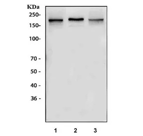 NMDAR2B Antibody / GRIN2B - image 1