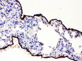 Mesothelin Antibody - image 1