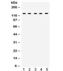 TRPM8 Antibody - image 1