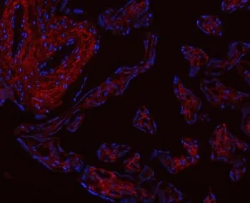 Collagen I Antibody / COL1A1 - image 1