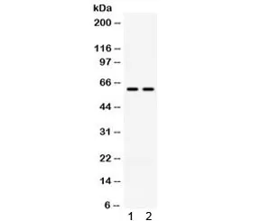 TCP1 gamma Antibody / CCT3 - image 1