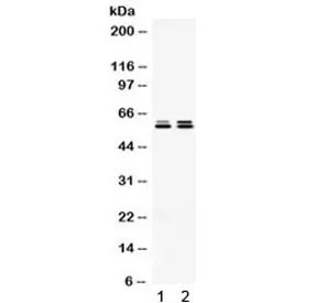 TCP1 epsilon Antibody / CCT5 - image 1