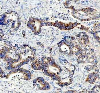 AMACR / p504S Antibody (Prostate Cancer Marker) - image 1