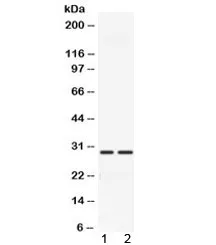 CA3 Antibody / Carbonic Anhydrase III - image 1
