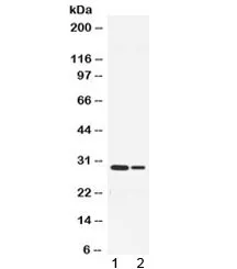 Neutrophil Elastase Antibody - image 1