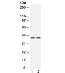 TXNL2 Antibody / GLRX3 - image 1