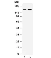 Insulin Receptor Antibody / INSR - image 1