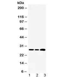 RPL19 Antibody / Ribosomal protein L19 - image 1