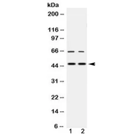 MPI Antibody / Mannose Phosphate Isomerase - image 1