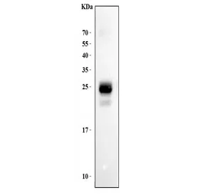 HLA-DPB1 Antibody (MHC II) - image 1