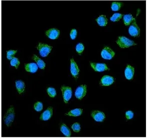 Alkaline phosphatase Antibody (placental) - image 1