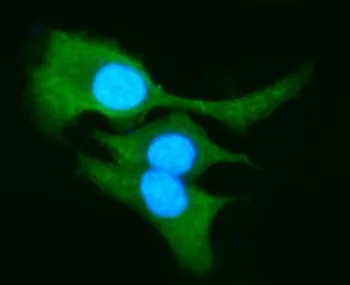 AKR1B10 Antibody - image 1
