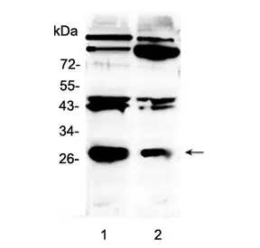PDGF beta Antibody - image 1